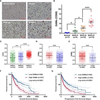 Epithelial-mesenchymal transition is the main way in which glioma-associated microglia/macrophages promote glioma progression